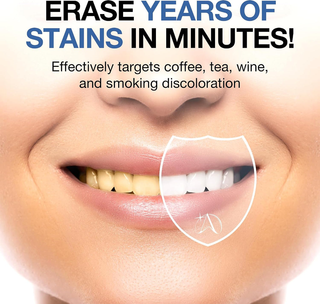 ALTEGAORI Teeth Whitening Strips – 14 Treatments / 28 Strips